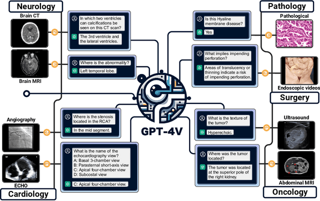Figure 1 for Multimodal ChatGPT for Medical Applications: an Experimental Study of GPT-4V