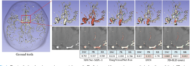 Figure 4 for 3D Vessel Segmentation with Limited Guidance of 2D Structure-agnostic Vessel Annotations