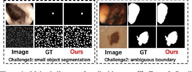 Figure 1 for DuAT: Dual-Aggregation Transformer Network for Medical Image Segmentation