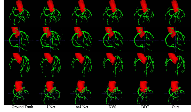 Figure 4 for Graph Convolution Based Cross-Network Multi-Scale Feature Fusion for Deep Vessel Segmentation