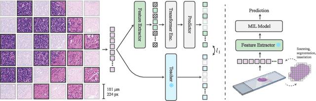 Figure 3 for Fine-tuning a Multiple Instance Learning Feature Extractor with Masked Context Modelling and Knowledge Distillation