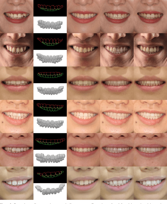 Figure 4 for OrthoGAN:High-Precision Image Generation for Teeth Orthodontic Visualization