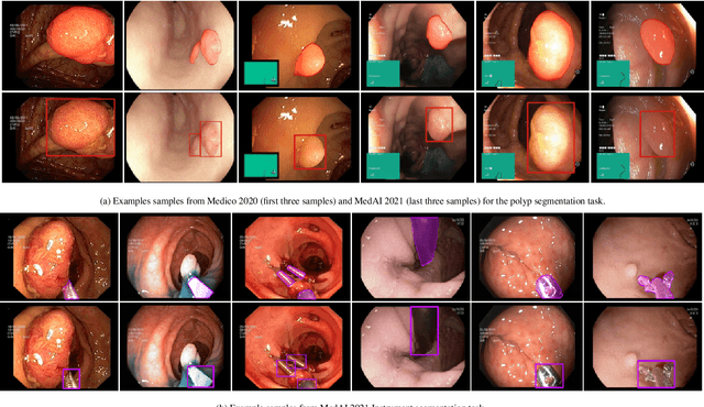 Figure 3 for An objective validation of polyp and instrument segmentation methods in colonoscopy through Medico 2020 polyp segmentation and MedAI 2021 transparency challenges