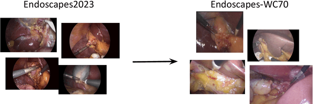 Figure 1 for Optimizing Latent Graph Representations of Surgical Scenes for Zero-Shot Domain Transfer