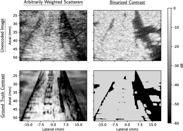 Figure 3 for Optimization of Array Encoding for Ultrasound Imaging