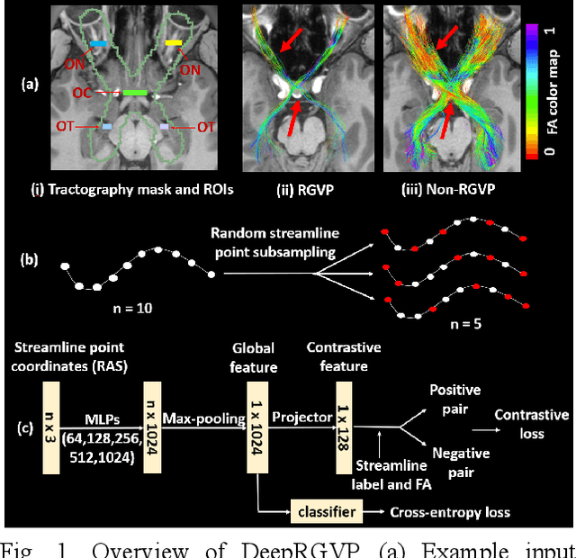 Figure 1 for DeepRGVP: A Novel Microstructure-Informed Supervised Contrastive Learning Framework for Automated Identification Of The Retinogeniculate Pathway Using dMRI Tractography