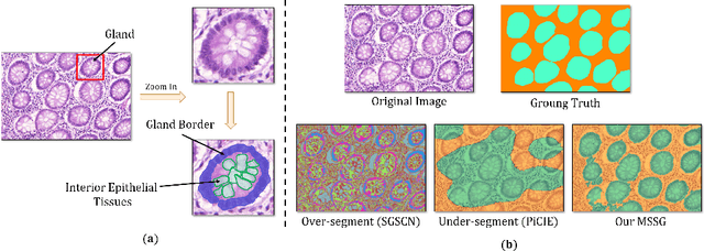 Figure 1 for Morphology-inspired Unsupervised Gland Segmentation via Selective Semantic Grouping