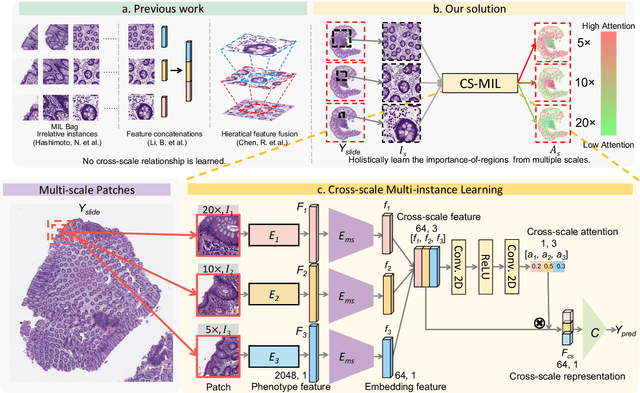Figure 3 for Cross-scale Multi-instance Learning for Pathological Image Diagnosis
