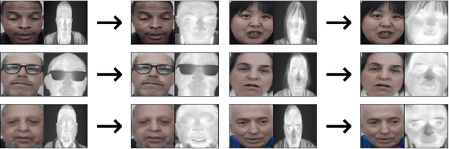 Figure 1 for A Generative Approach for Image Registration of Visible-Thermal (VT) Cancer Faces