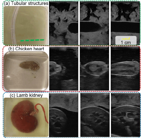 Figure 1 for Intelligent Robotic Sonographer: Mutual Information-based Disentangled Reward Learning from Few Demonstrations