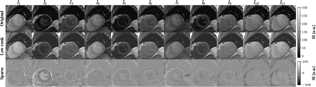Figure 3 for Contrast-Agnostic Groupwise Registration by Robust PCA for Quantitative Cardiac MRI