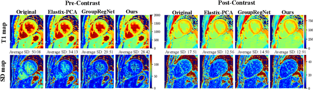 Figure 4 for Contrast-Agnostic Groupwise Registration by Robust PCA for Quantitative Cardiac MRI