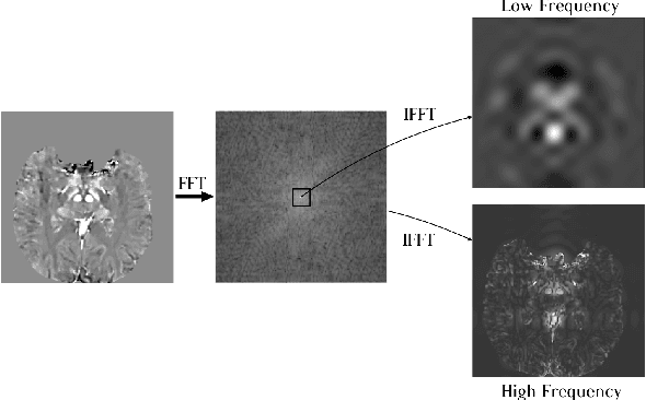 Figure 3 for Fourier Disentangled Multimodal Prior Knowledge Fusion for Red Nucleus Segmentation in Brain MRI