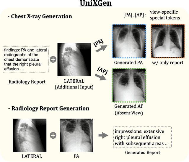 Figure 1 for Unified Chest X-ray and Radiology Report Generation Model with Multi-view Chest X-rays