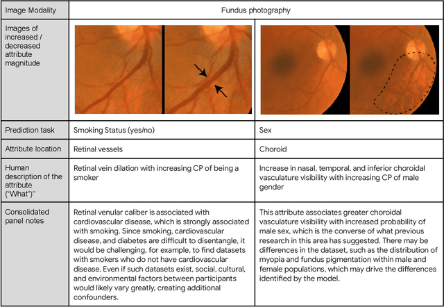 Figure 4 for Using generative AI to investigate medical imagery models and datasets
