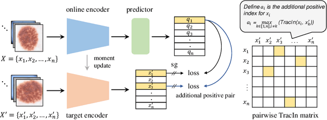 Figure 1 for Additional Positive Enables Better Representation Learning for Medical Images