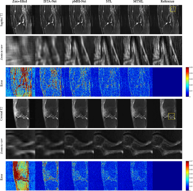 Figure 2 for Multi-task Magnetic Resonance Imaging Reconstruction using Meta-learning