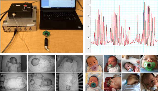 Figure 1 for A Video-based End-to-end Pipeline for Non-nutritive Sucking Action Recognition and Segmentation in Young Infants