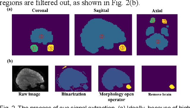 Figure 3 for MRGazer: Decoding Eye Gaze Points from Functional Magnetic Resonance Imaging in Individual Space