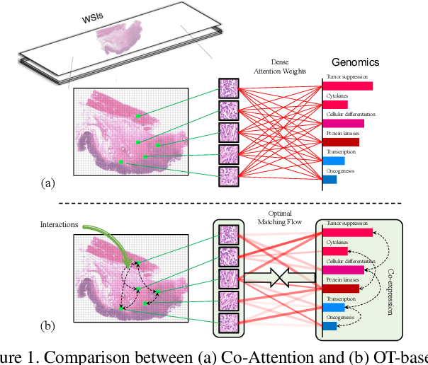Figure 1 for Multimodal Optimal Transport-based Co-Attention Transformer with Global Structure Consistency for Survival Prediction