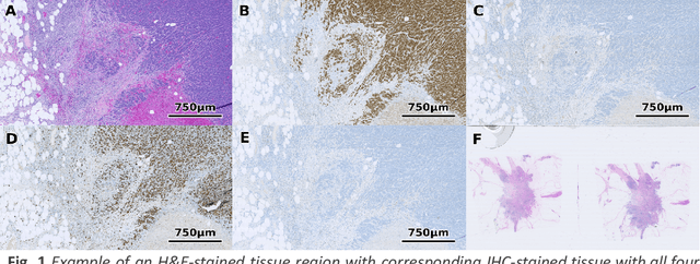 Figure 1 for ACROBAT -- a multi-stain breast cancer histological whole-slide-image data set from routine diagnostics for computational pathology