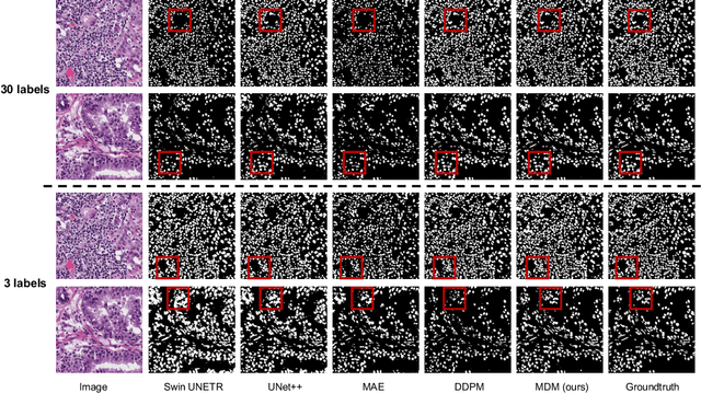 Figure 4 for Masked Diffusion as Self-supervised Representation Learner