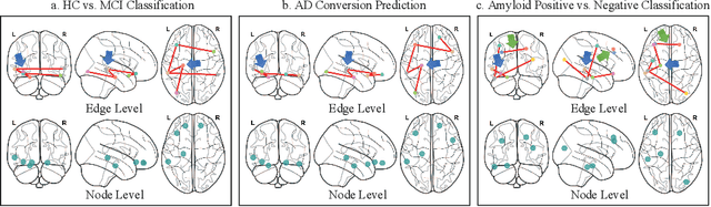 Figure 3 for Beyond the Snapshot: Brain Tokenized Graph Transformer for Longitudinal Brain Functional Connectome Embedding