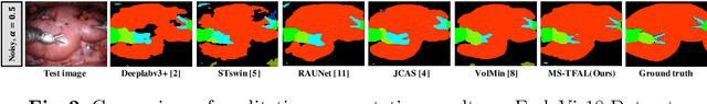 Figure 3 for Rectifying Noisy Labels with Sequential Prior: Multi-Scale Temporal Feature Affinity Learning for Robust Video Segmentation