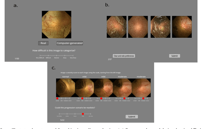 Figure 3 for Evaluating clinical diversity and plausibility of synthetic capsule endoscopic images