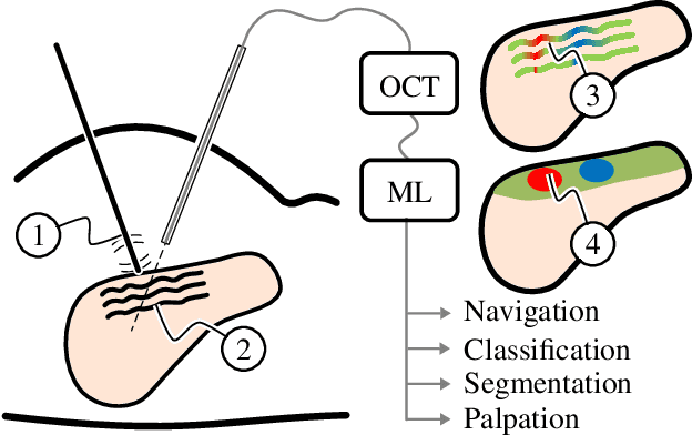 Figure 1 for A Modified da Vinci Surgical Instrument for OCE based Elasticity Estimation with Deep Learning
