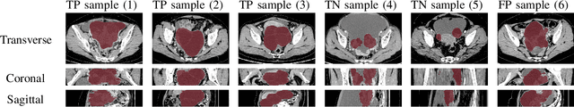 Figure 4 for Multi-View Attention Learning for Residual Disease Prediction of Ovarian Cancer