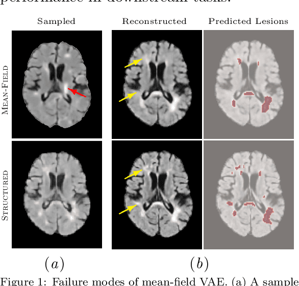 Figure 1 for Clinically Plausible Pathology-Anatomy Disentanglement in Patient Brain MRI with Structured Variational Priors