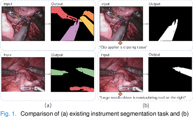 Figure 1 for Video-Instrument Synergistic Network for Referring Video Instrument Segmentation in Robotic Surgery