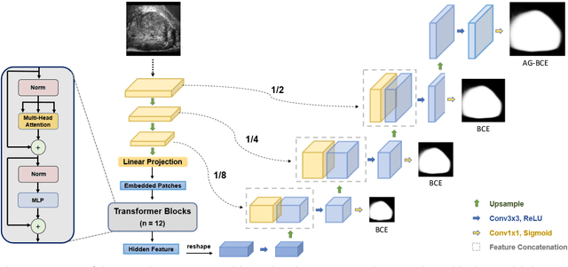 Figure 3 for MicroSegNet: A Deep Learning Approach for Prostate Segmentation on Micro-Ultrasound Images