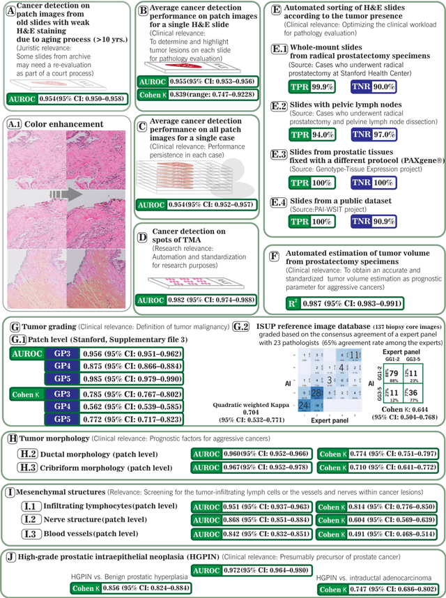 Figure 1 for Critical Evaluation of Artificial Intelligence as Digital Twin of Pathologist for Prostate Cancer Pathology