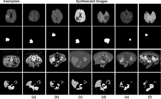 Figure 2 for Cheap Lunch for Medical Image Segmentation by Fine-tuning SAM on Few Exemplars