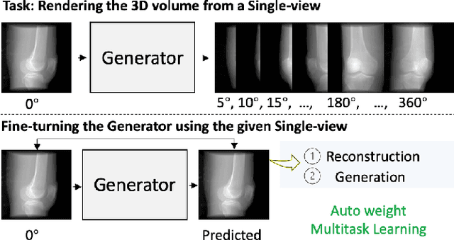 Figure 1 for UMedNeRF: Uncertainty-aware Single View Volumetric Rendering for Medical Neural Radiance Fields