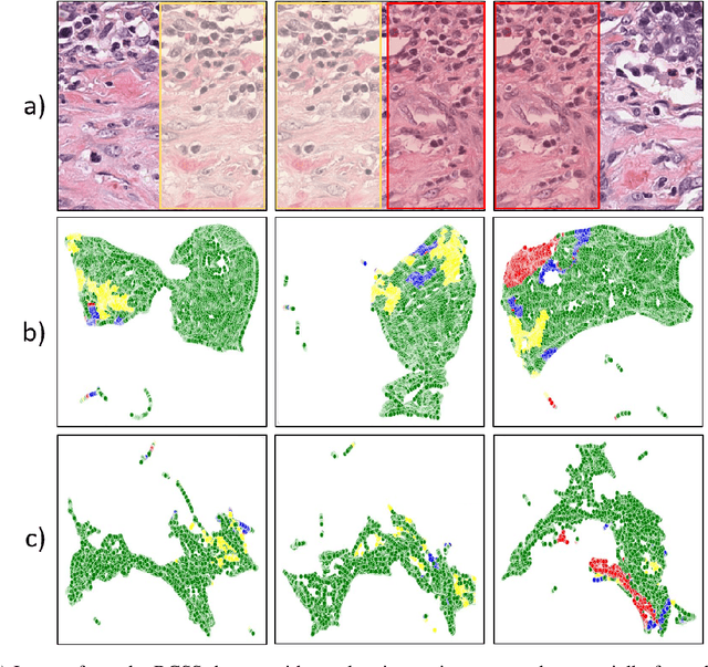 Figure 3 for Consistency Regularisation in Varying Contexts and Feature Perturbations for Semi-Supervised Semantic Segmentation of Histology Images