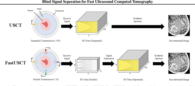 Figure 1 for Blind Signal Separation for Fast Ultrasound Computed Tomography