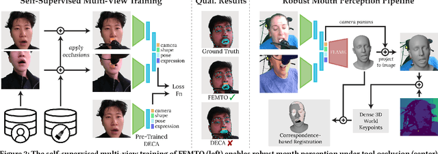 Figure 3 for Feel the Bite: Robot-Assisted Inside-Mouth Bite Transfer using Robust Mouth Perception and Physical Interaction-Aware Control