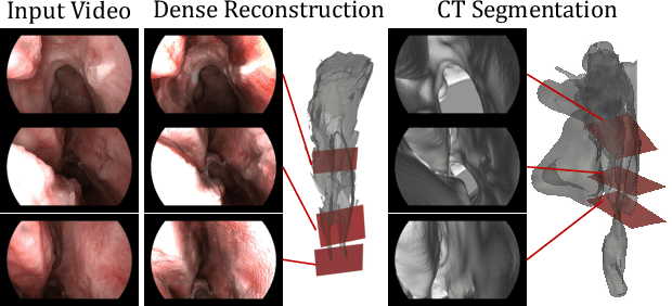 Figure 1 for A Quantitative Evaluation of Dense 3D Reconstruction of Sinus Anatomy from Monocular Endoscopic Video