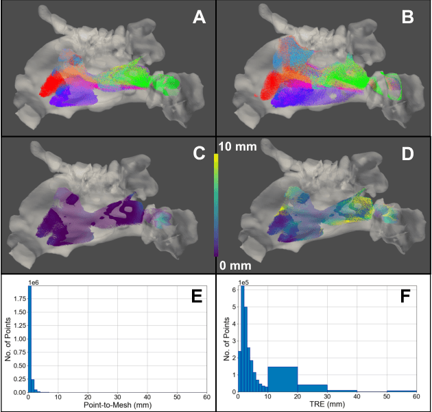 Figure 2 for A Quantitative Evaluation of Dense 3D Reconstruction of Sinus Anatomy from Monocular Endoscopic Video
