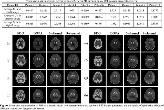 Figure 2 for PET Tracer Conversion among Brain PET via Variable Augmented Invertible Network