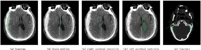 Figure 1 for TBI Image/Text (TBI-IT): Comprehensive Text and Image Datasets for Traumatic Brain Injury Research