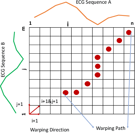Figure 1 for Side Channel-Assisted Inference Leakage from Machine Learning-based ECG Classification