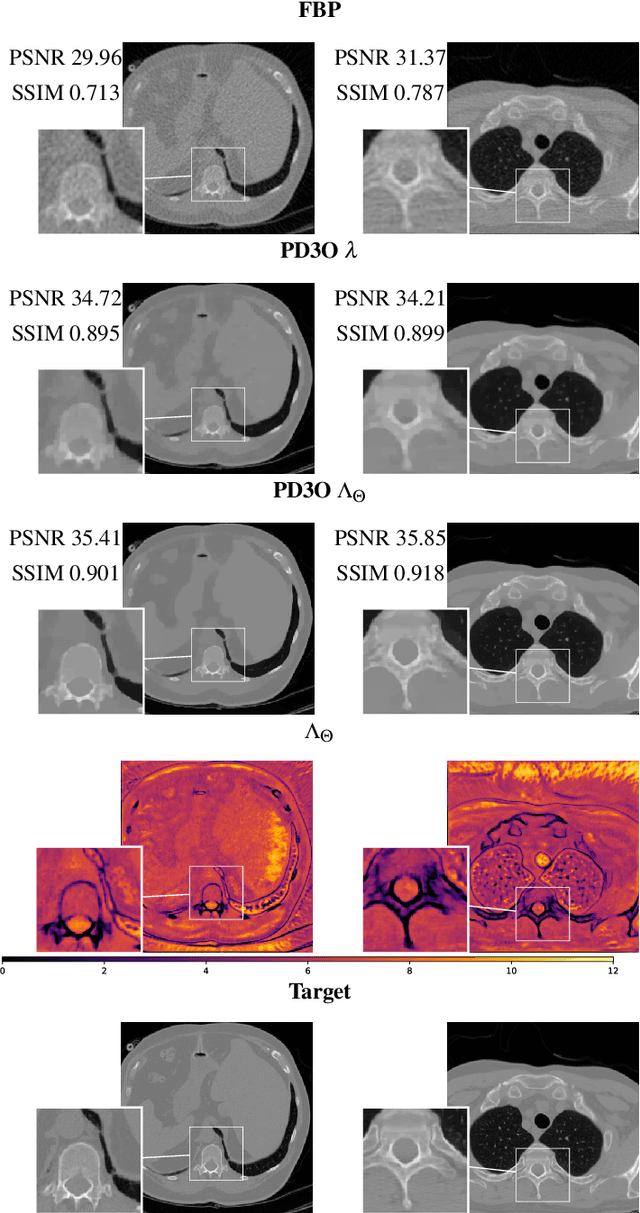 Figure 2 for Unrolled three-operator splitting for parameter-map learning in Low Dose X-ray CT reconstruction