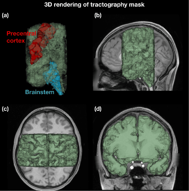 Figure 4 for Reconstructing the somatotopic organization of the corticospinal tract remains a challenge for modern tractography methods