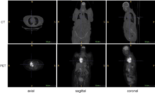 Figure 3 for Deep evidential fusion with uncertainty quantification and contextual discounting for multimodal medical image segmentation