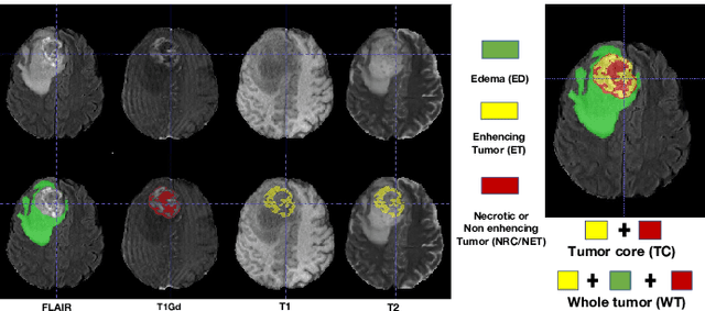 Figure 4 for Deep evidential fusion with uncertainty quantification and contextual discounting for multimodal medical image segmentation