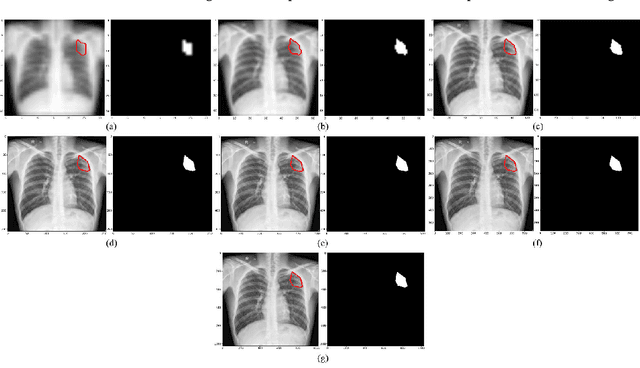 Figure 1 for Does image resolution impact chest X-ray based fine-grained Tuberculosis-consistent lesion segmentation?
